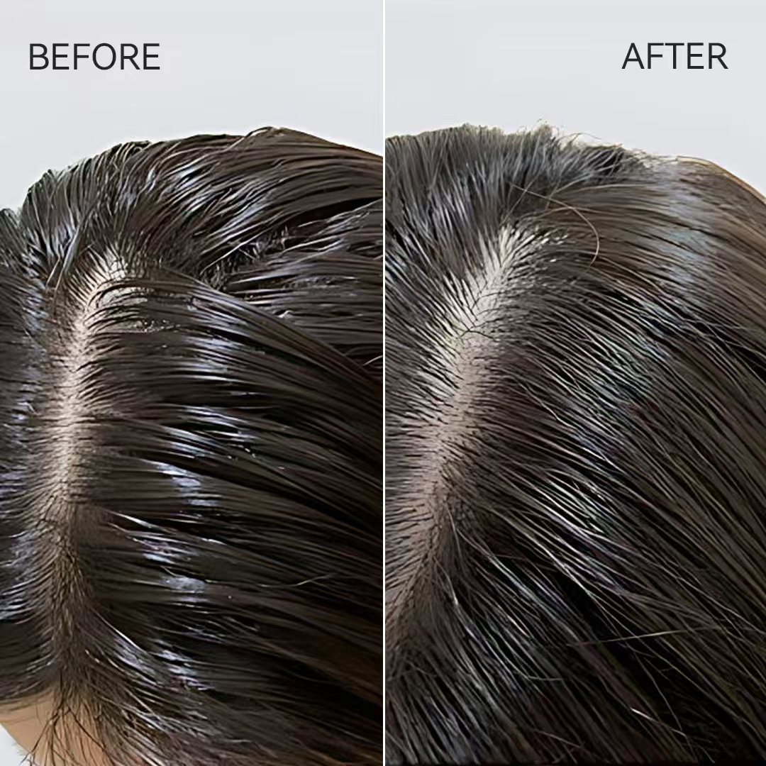 Yitree Herbal Scalp Energizing Treatment Cream (for oily scalp) - Image 3